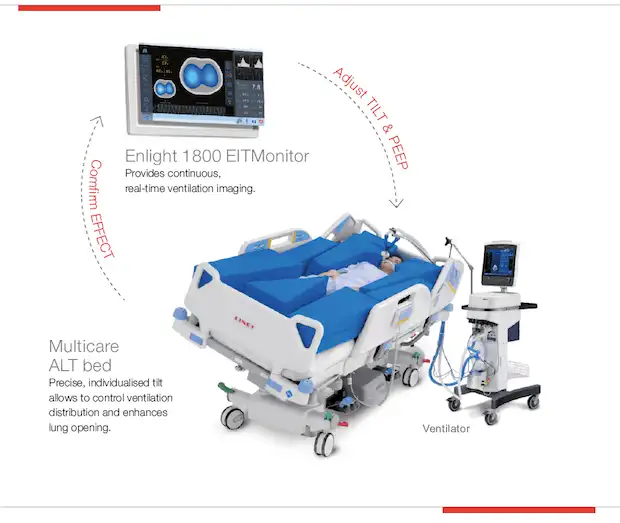Lungeventilation respiratorpatienter